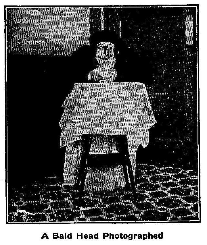 A Bald Head Photographed