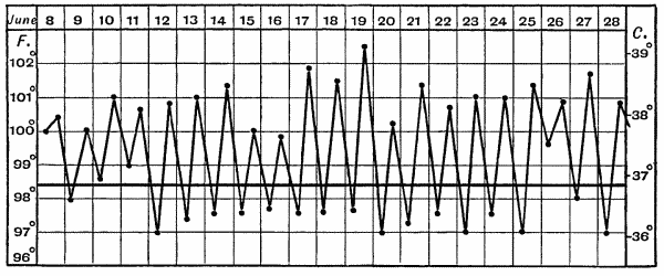 Fig. 11.&mdash;Chart of Hectic Fever.
