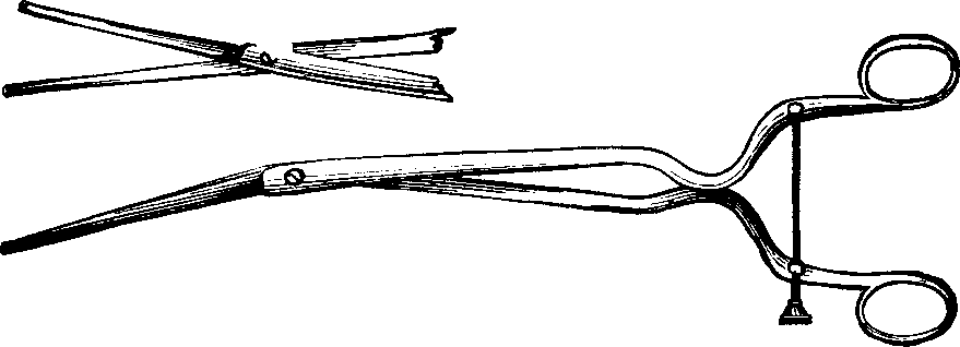 Illustration:
Fig. 5. STOHLMAN'S HYSTEROTOME. This instrument has two cutting blades
which shut past each other, as seen in the lower figure, so as not to cut
when introduced into the canal of the uterine neck. After introduction, the
cutting blades are separated, as shown in the upper figure, the extent of
the incision being regulated by the thumb-screw attached to the handles, as
represented in the lower figure.