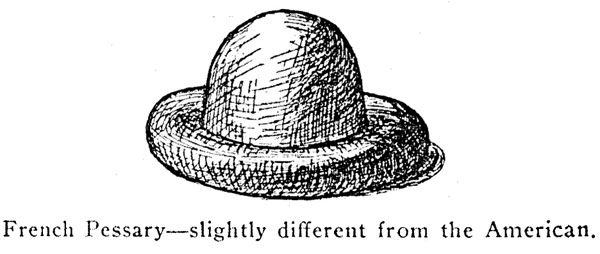 French Pessary&mdash;slightly different from the American.